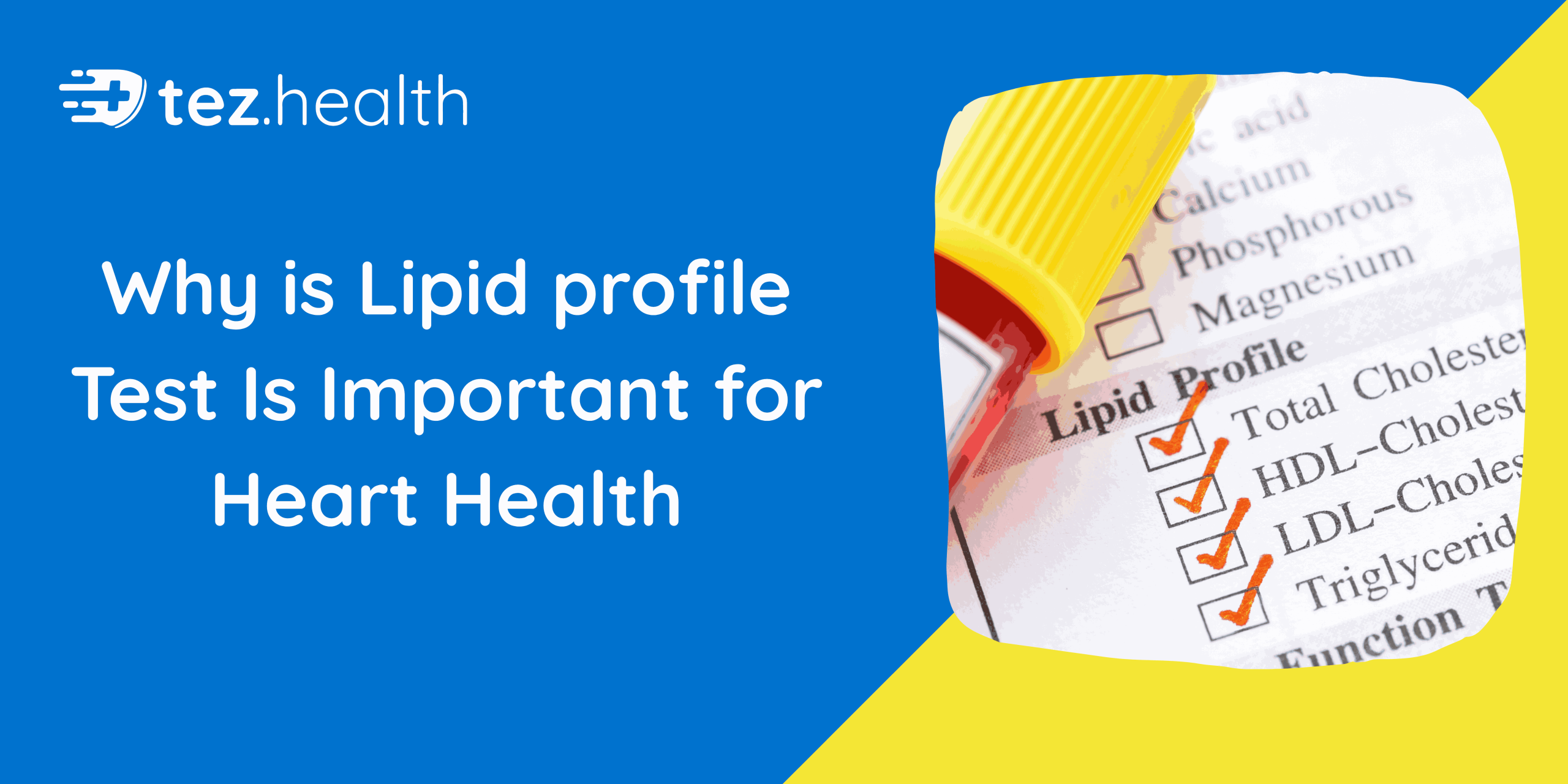 Why a Lipid Profile Test Is Important for Heart Health