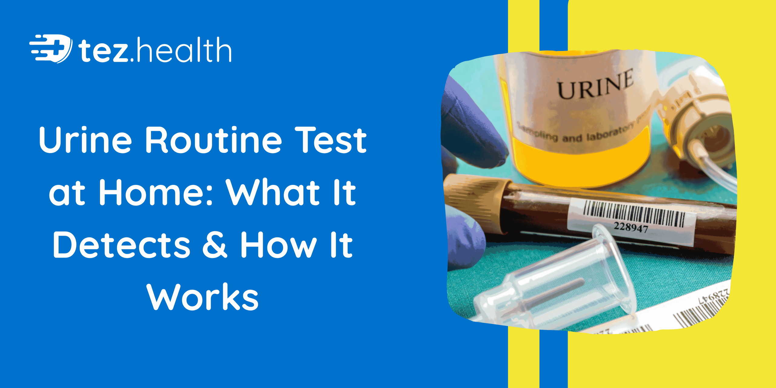 Urine Routine Test at Home: What It Detects & How It Works.