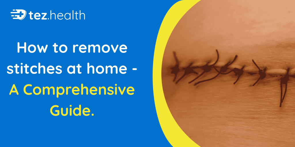 How to Remove Stitches at Home – A Comprehensive Guide