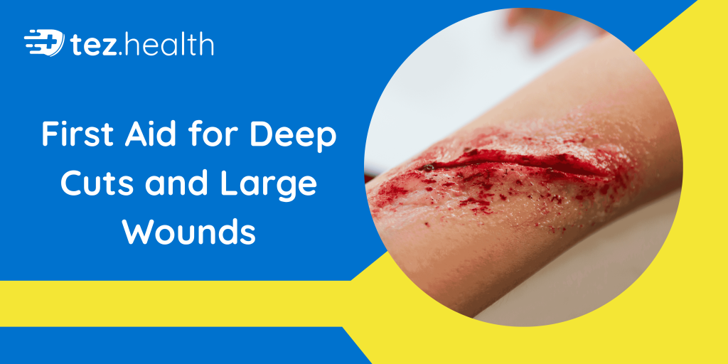 First Aid for Deep Cuts and Large Wounds