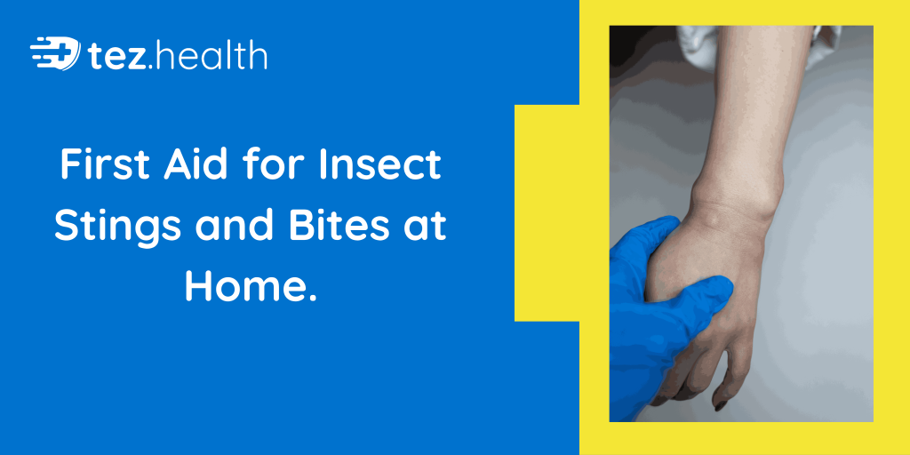 First Aid for Insect Stings and Bites at Home