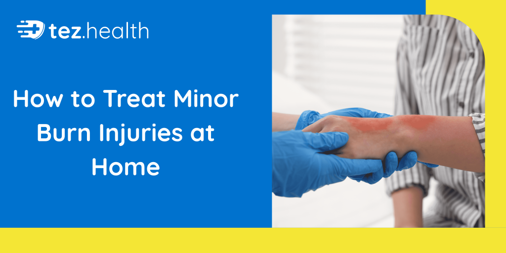 How to Treat Minor Burn Injuries at Home