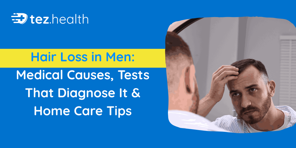 Hair Loss in Men: Medical Causes, Tests That Diagnose It & Home Care Tips