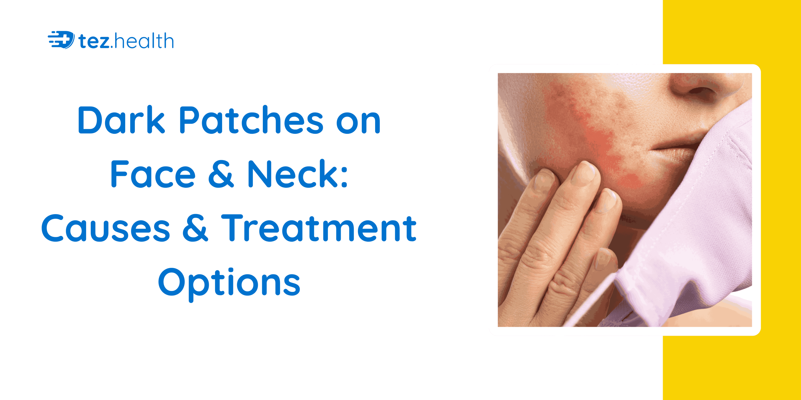 Dark Patches on Face & Neck: Causes & Treatment Options